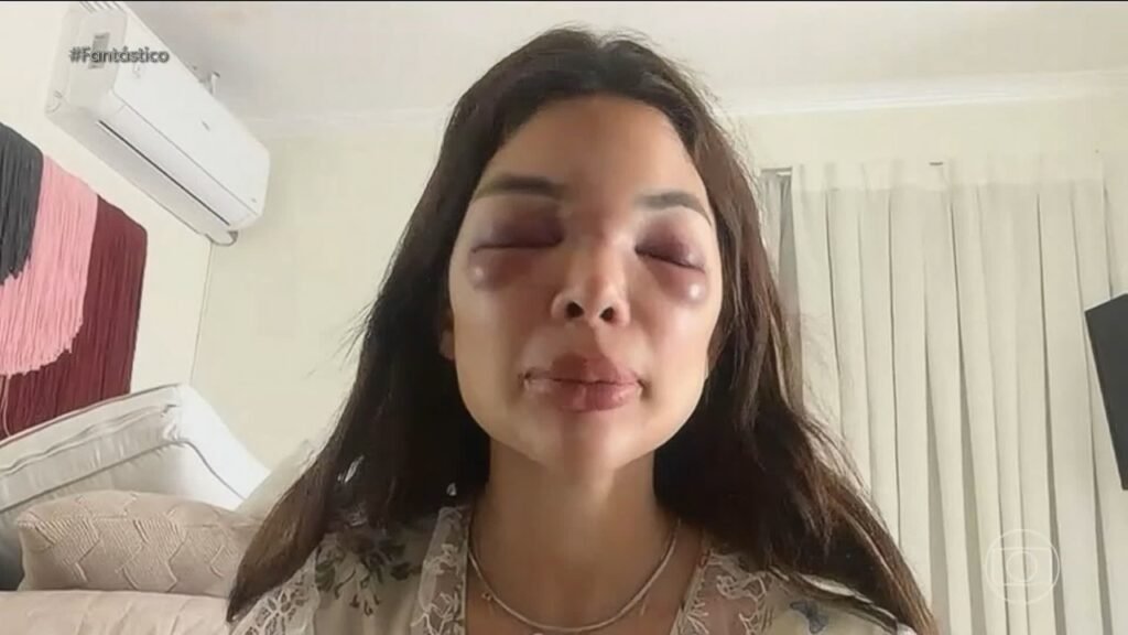 Empresário da Faria Lima é preso após câmeras flagrarem espancamento da esposa dentista em SP