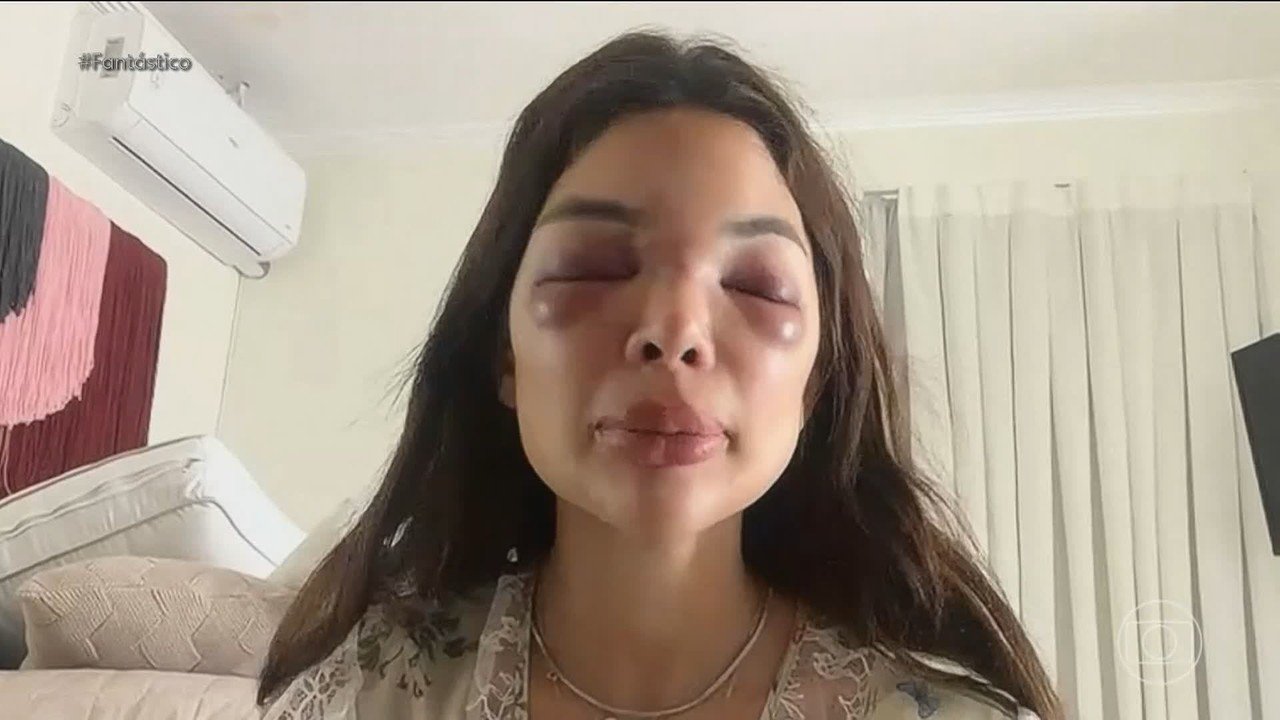 Empresário da Faria Lima é preso após câmeras flagrarem espancamento da esposa dentista em SP - Imagem do artigo