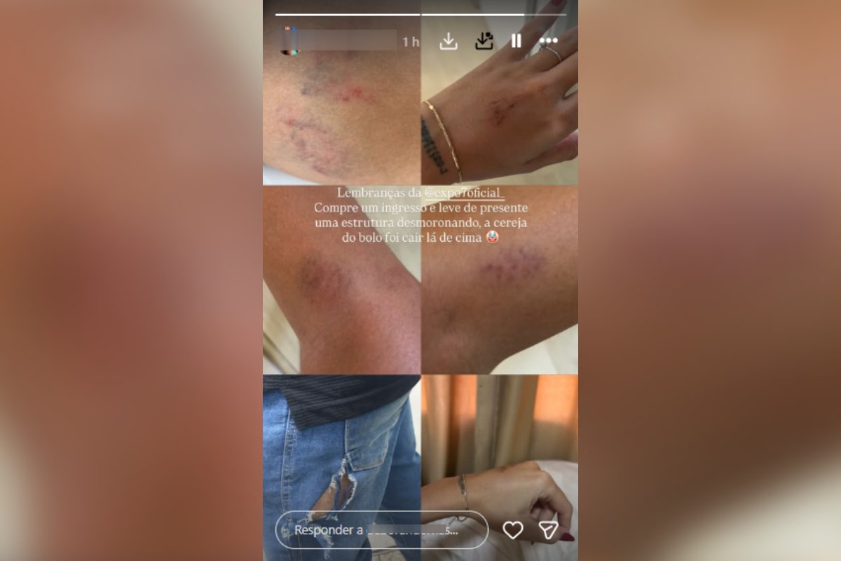 Palco auxiliar cede na madrugada e fere 12 pessoas durante a Exposete em Sete Lagoas - Imagem do artigo original